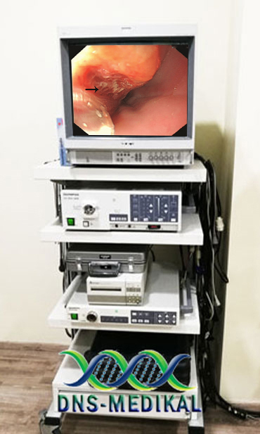 Gastroscop Olympus CV 140